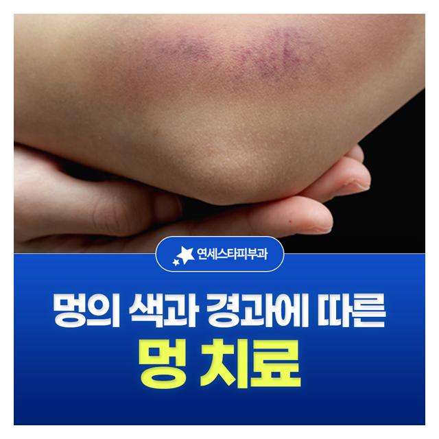 멍 치료는 멍의 색과 경과에 따라서 치료방법도 달라집니다